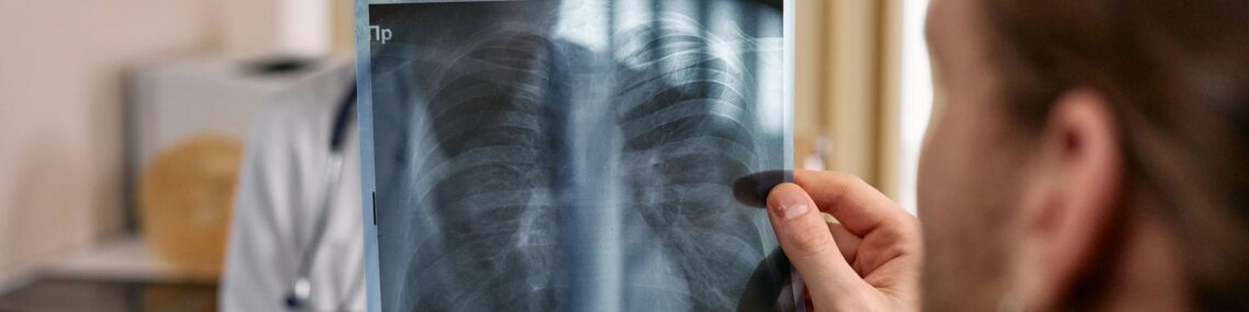 chest X-ray models